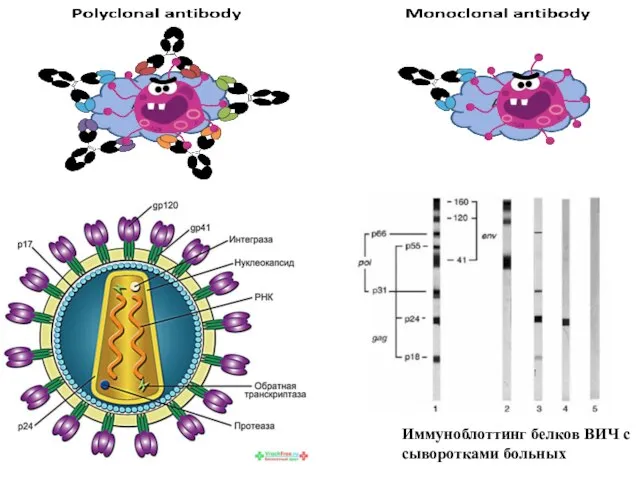 Иммуноблоттинг белков ВИЧ с сыворотками больных