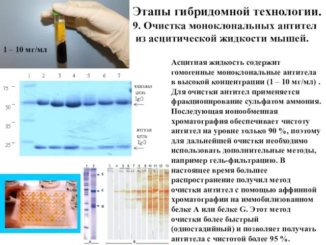 Этапы гибридомной технологии. 9. Очистка моноклональных антител из асцитической жидкости мышей. Асцитная