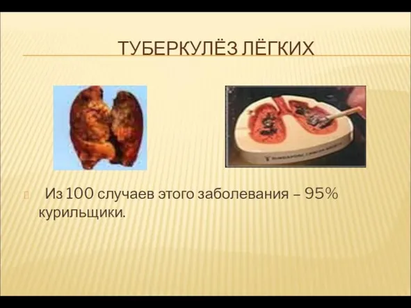 ТУБЕРКУЛЁЗ ЛЁГКИХ Из 100 случаев этого заболевания – 95% курильщики.