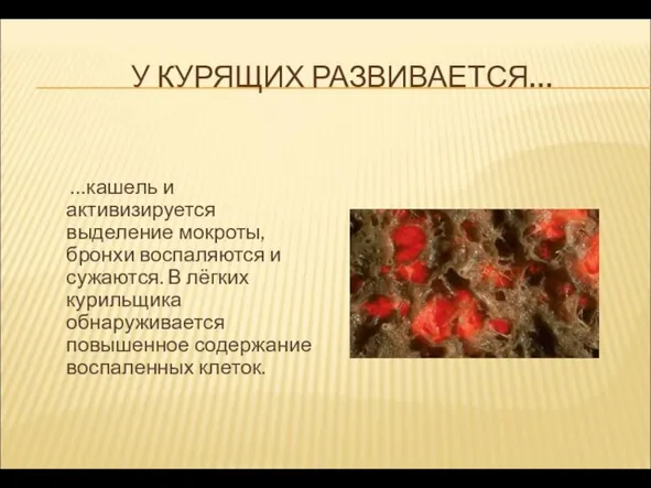 У КУРЯЩИХ РАЗВИВАЕТСЯ… …кашель и активизируется выделение мокроты, бронхи воспаляются и сужаются.