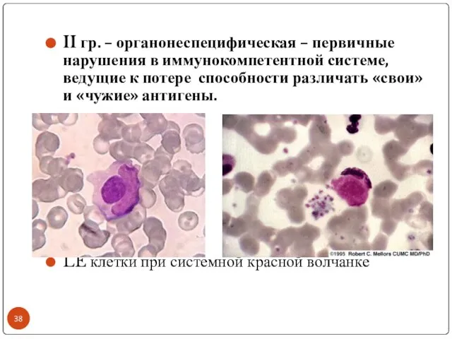 II гр. – органонеспецифическая – первичные нарушения в иммунокомпетентной системе, ведущие к