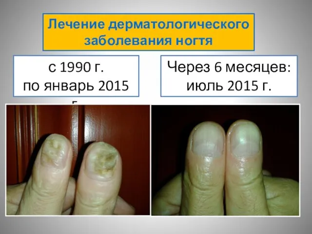 с 1990 г. по январь 2015 г. Через 6 месяцев: июль 2015