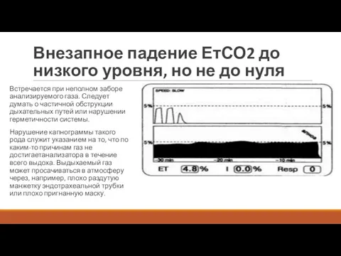 Внезапное падение ЕтСО2 до низкого уровня, но не до нуля Встречается при