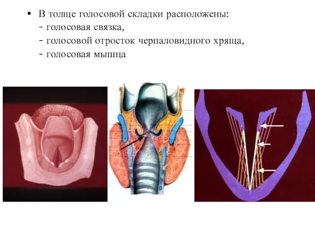 В толще голосовой складки расположены: - голосовая связка, - голосовой отросток черпаловидного хряща, - голосовая мышца