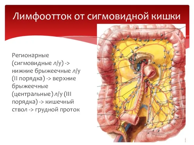 Регионарные (сигмовидные л/у) -> нижние брыжеечные л/у (II порядка) -> верхние брыжеечные