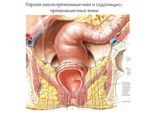 Парная околопрямокишечная и седалищно - прямокишечные ямки