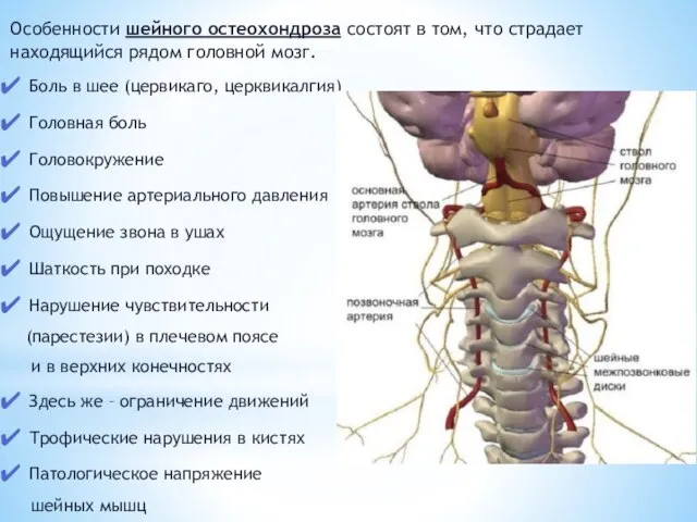 Особенности шейного остеохондроза состоят в том, что страдает находящийся рядом головной мозг.