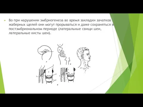 Во при нарушении эмбриогенеза во время закладки зачатков жаберных щелей они могут