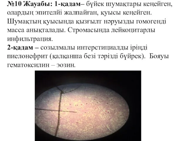 №10 Жауабы: 1-қадам– бүйек шумақтары кеңейген, олардың эпителйі жалпайған, қуысы кеңейген. Шумақтың