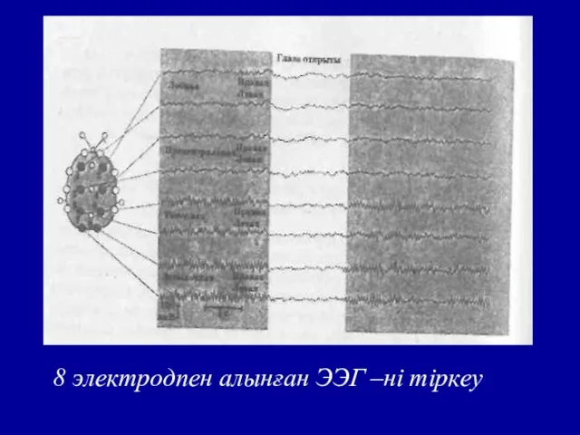 8 электродпен алынған ЭЭГ –ні тіркеу