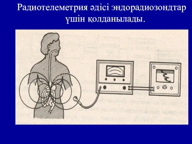 Радиотелеметрия әдісі эндорадиозондтар үшін қолданылады.