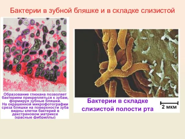 Бактерии в зубной бляшке и в складке слизистой