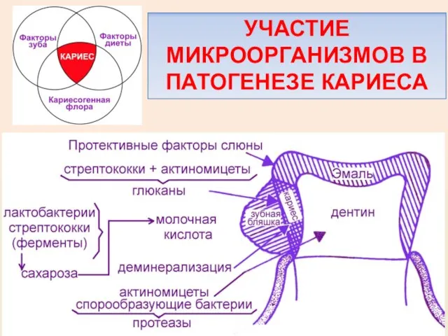 УЧАСТИЕ МИКРООРГАНИЗМОВ В ПАТОГЕНЕЗЕ КАРИЕСА