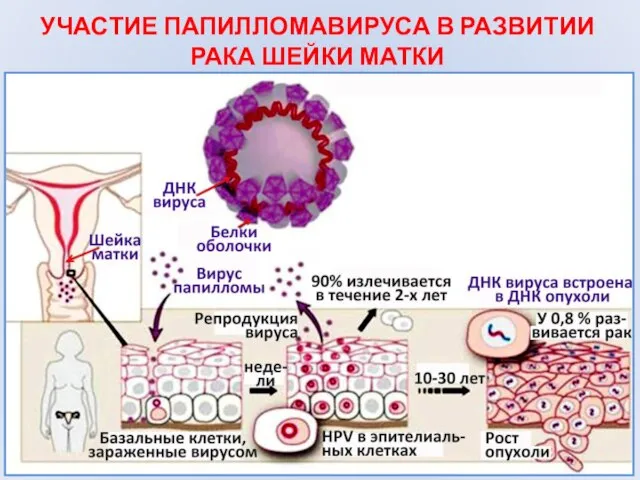 УЧАСТИЕ ПАПИЛЛОМАВИРУСА В РАЗВИТИИ РАКА ШЕЙКИ МАТКИ