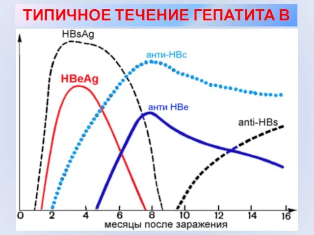 ТИПИЧНОЕ ТЕЧЕНИЕ ГЕПАТИТА В