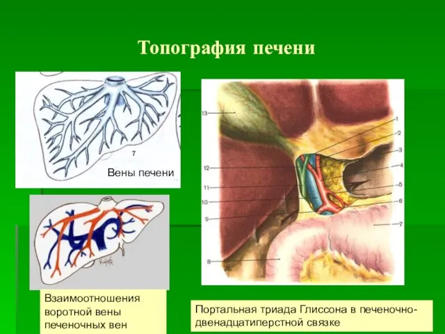 Топография печени Взаимоотношения воротной вены печеночных вен Портальная триада Глиссона в печеночно-двенадцатиперстной связке Вены печени