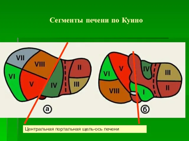 Сегменты печени по Куино Центральная портальная щель-ось печени