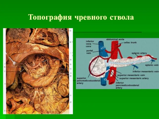 Топография чревного ствола