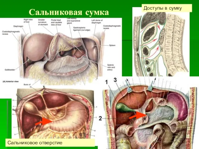 Сальниковая сумка Доступы в сумку Сальниковое отверстие