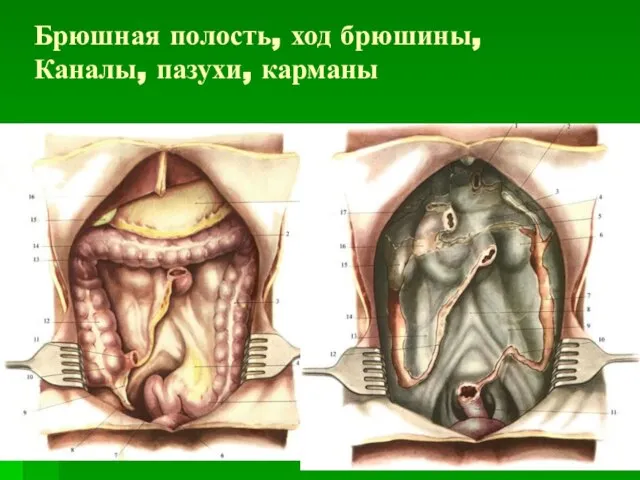 Брюшная полость, ход брюшины, Каналы, пазухи, карманы Каналы, пазухи, карманы