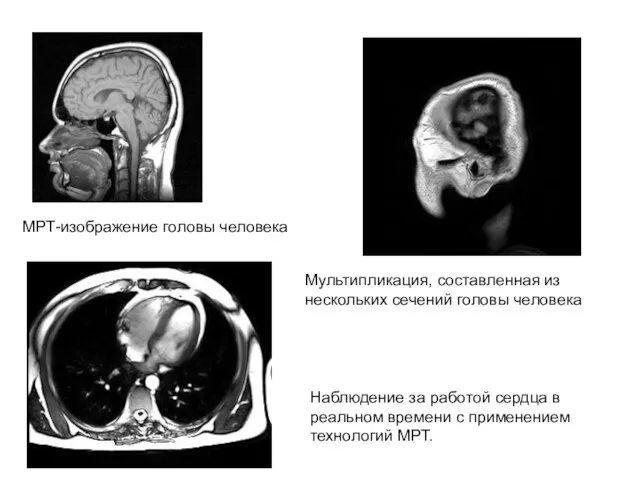 МРТ-изображение головы человека Мультипликация, составленная из нескольких сечений головы человека Наблюдение за