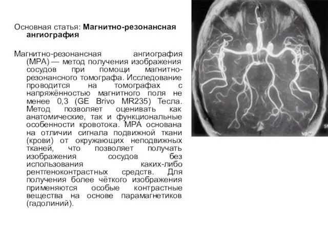 Основная статья: Магнитно-резонансная ангиография Магнитно-резонансная ангиография (МРА) — метод получения изображения сосудов