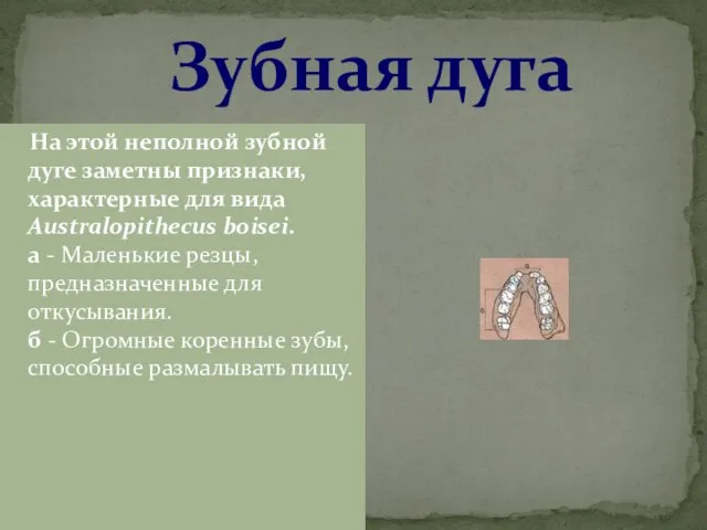 Зубная дуга На этой неполной зубной дуге заметны признаки, характерные для вида