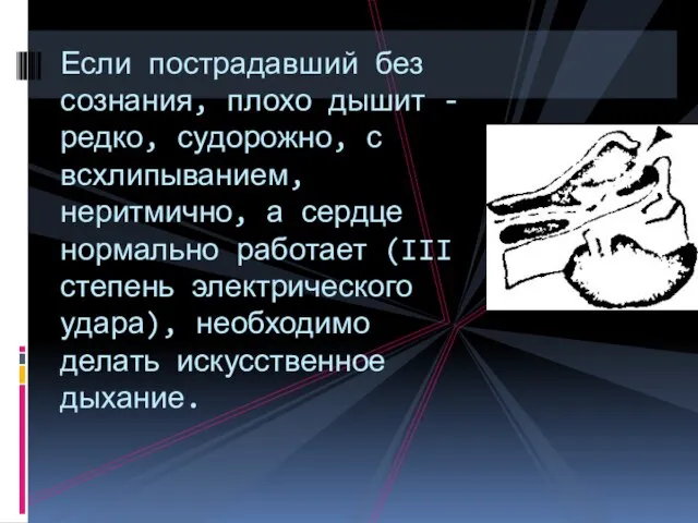 Если пострадавший без сознания, плохо дышит - редко, судорожно, с всхлипыванием, неритмично,