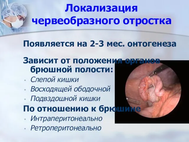 Локализация червеобразного отростка Появляется на 2-3 мес. онтогенеза Зависит от положения органов