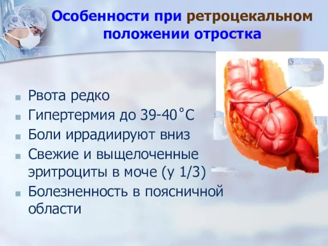 Рвота редко Гипертермия до 39-40˚С Боли иррадиируют вниз Свежие и выщелоченные эритроциты