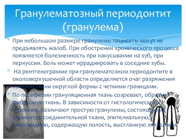 При небольшом размере гранулемы пациенты могут не предъявлять жалоб. При обострении хронического