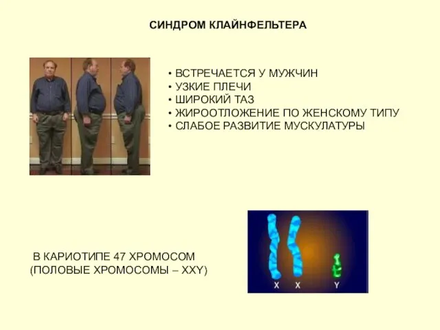 СИНДРОМ КЛАЙНФЕЛЬТЕРА ВСТРЕЧАЕТСЯ У МУЖЧИН УЗКИЕ ПЛЕЧИ ШИРОКИЙ ТАЗ ЖИРООТЛОЖЕНИЕ ПО ЖЕНСКОМУ