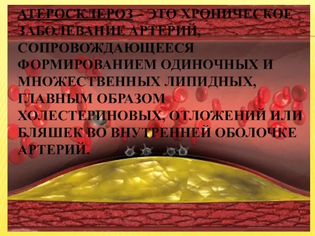 Атеросклероз – это хроническое заболевание артерий, сопровождающееся формированием одиночных и множественных липидных,