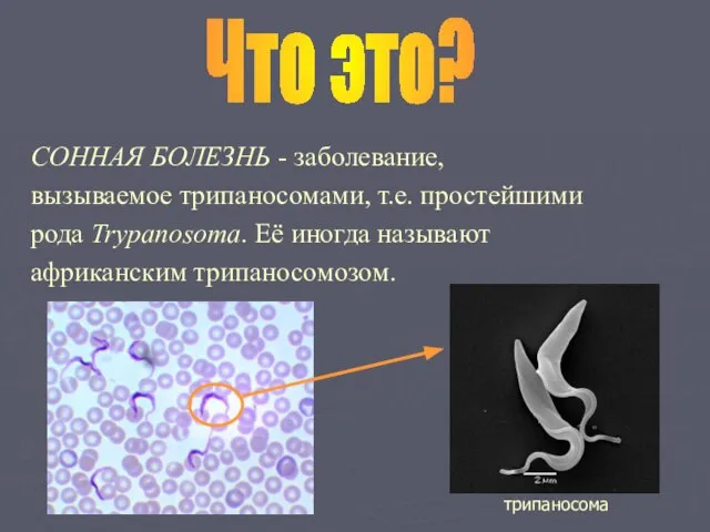 СОННАЯ БОЛЕЗНЬ - заболевание, вызываемое трипаносомами, т.е. простейшими рода Trypanosoma. Её иногда