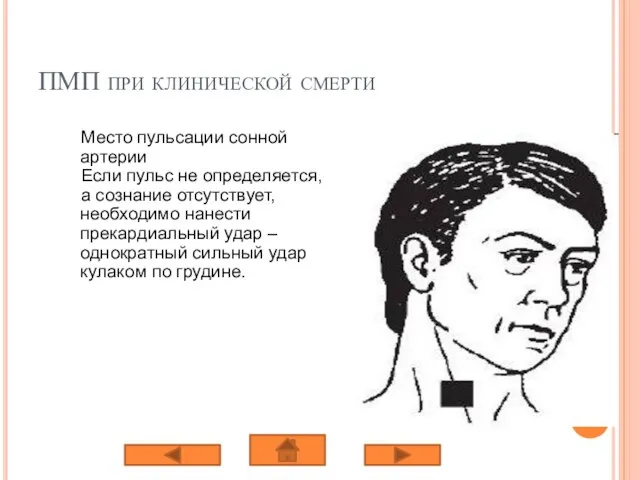 ПМП при клинической смерти Место пульсации сонной артерии Если пульс не определяется,