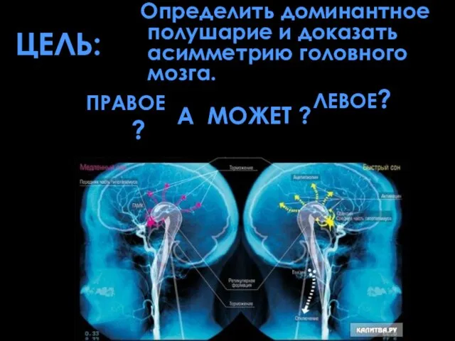 Цель: а может ? Определить доминантное полушарие и доказать асимметрию головного мозга. Левое? Правое ?