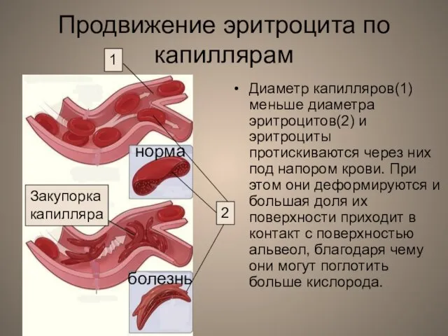 Продвижение эритроцита по капиллярам Диаметр капилляров(1) меньше диаметра эритроцитов(2) и эритроциты протискиваются