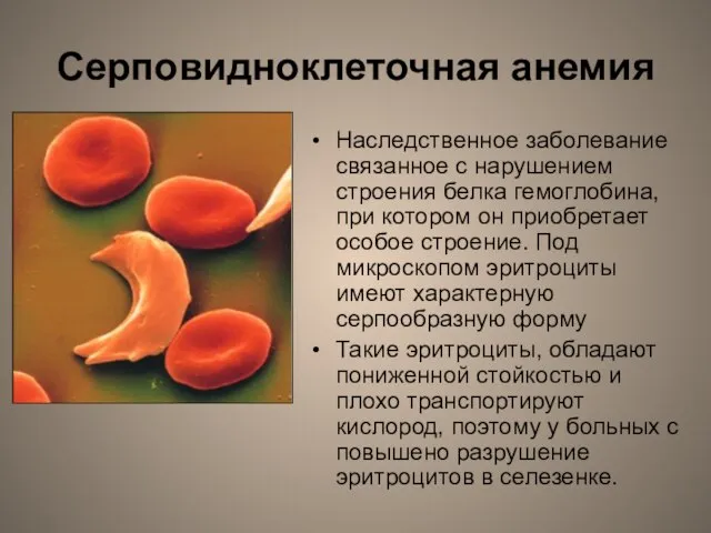 Серповидноклеточная анемия Наследственное заболевание связанное с нарушением строения белка гемоглобина, при котором