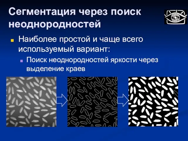 Сегментация через поиск неоднородностей Наиболее простой и чаще всего используемый вариант: Поиск