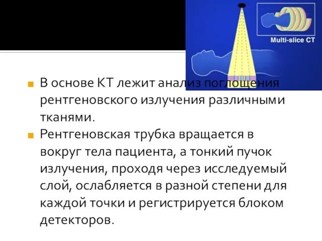 В основе КТ лежит анализ поглощения рентгеновского излучения различными тканями. Рентгеновская трубка