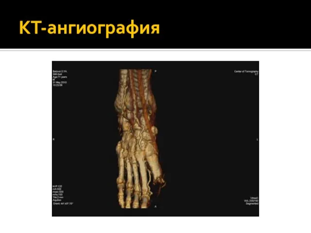 КТ-ангиография