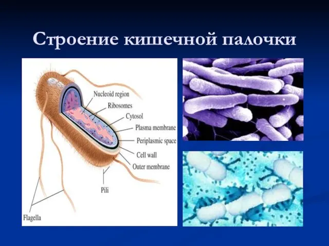 Строение кишечной палочки