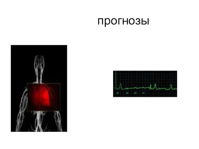 прогнозы