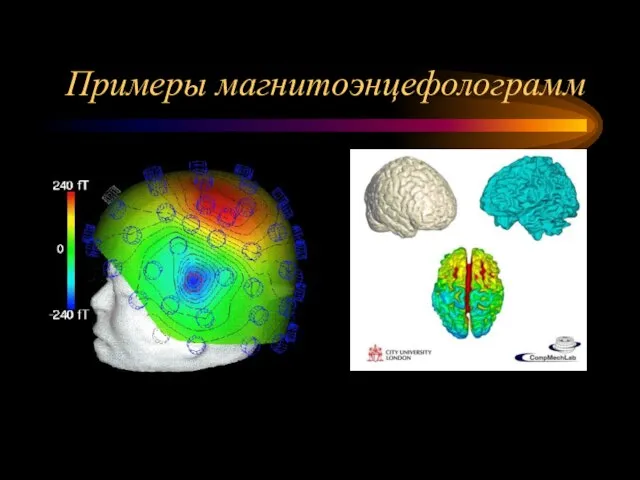 Примеры магнитоэнцефолограмм