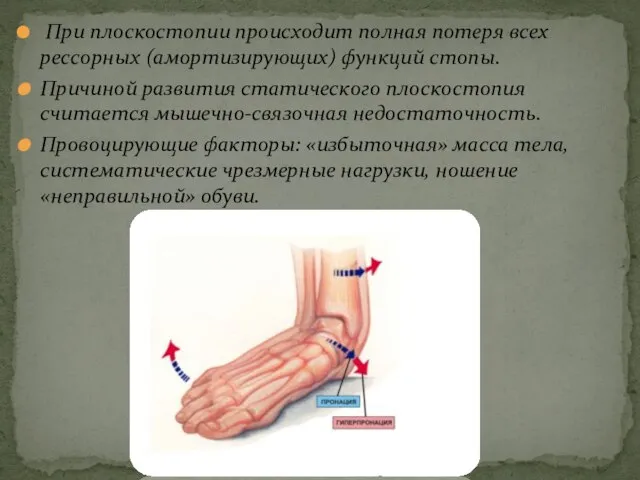 При плоскостопии происходит полная потеря всех рессорных (амортизирующих) функций стопы. Причиной развития