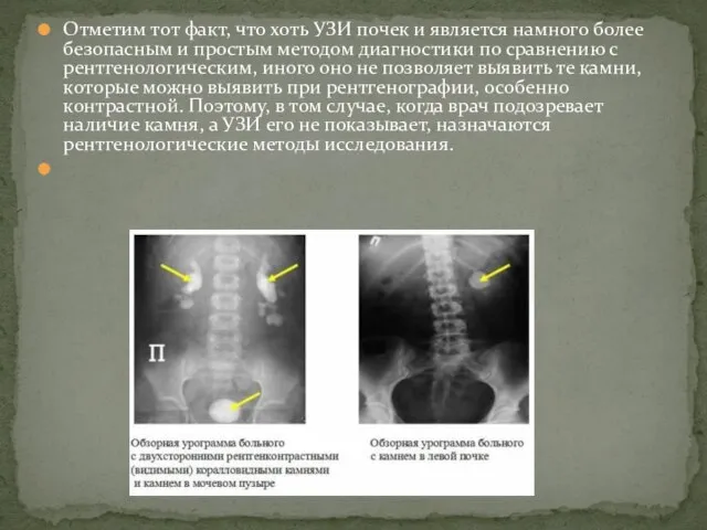 Отметим тот факт, что хоть УЗИ почек и является намного более безопасным