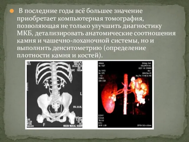 В последние годы всё большее значение приобретает компьютерная томография, позволяющая не только