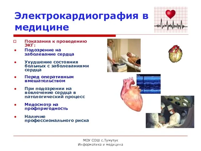 МОУ СОШ с.Тумутук Информатика и медицина Электрокардиография в медицине Показания к проведению