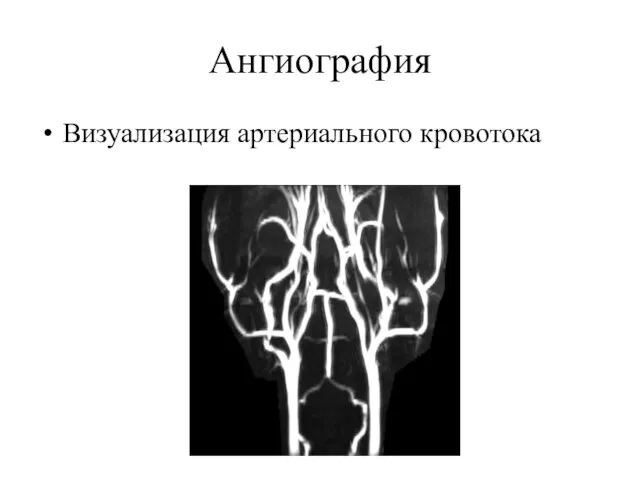 Ангиография Визуализация артериального кровотока