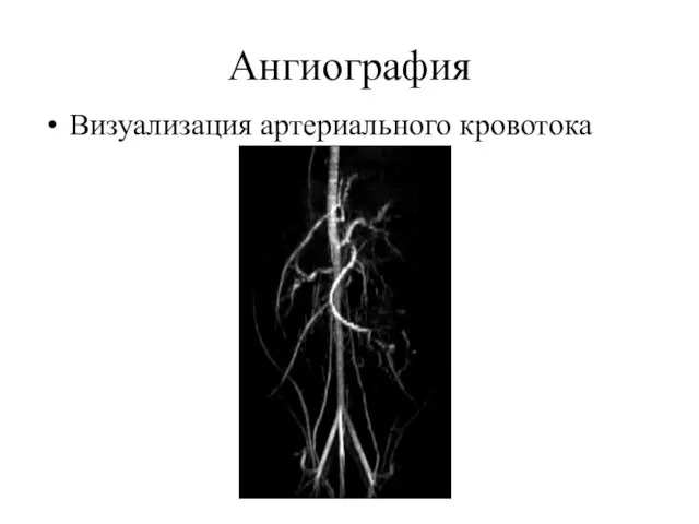 Ангиография Визуализация артериального кровотока